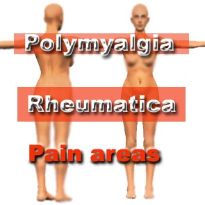 Celebrities With Polymyalgia Rheumatica