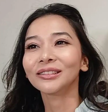 Dita Meichan Tampil Beda Usai Operasi, Terima Kasih Dokter Tompi!